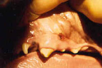 External drainage from abscessed fracture tooth